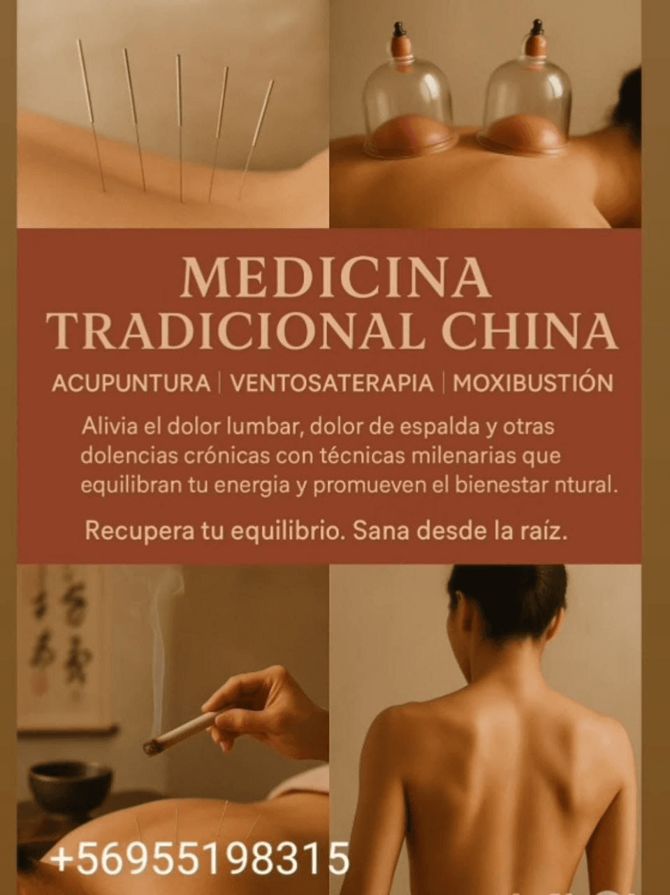 Recupera tu bienestar con Acupuntura a Domicilio.