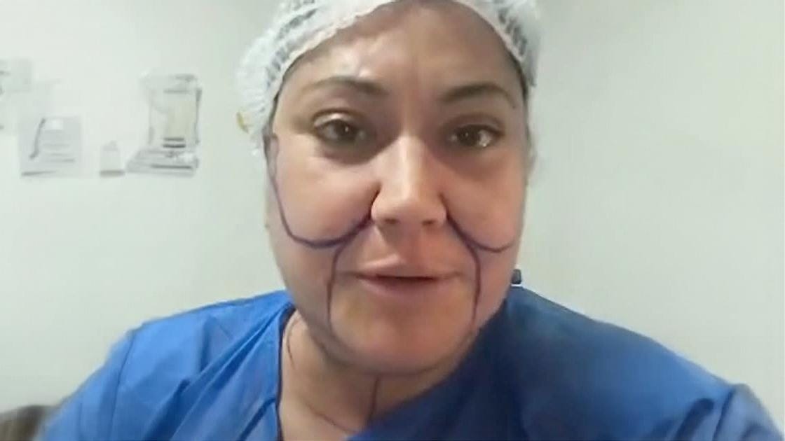 “Se sacó 10 AÑOS de encima”: La IMPACTANTE cirugía estética que se sometió Denisse Campos