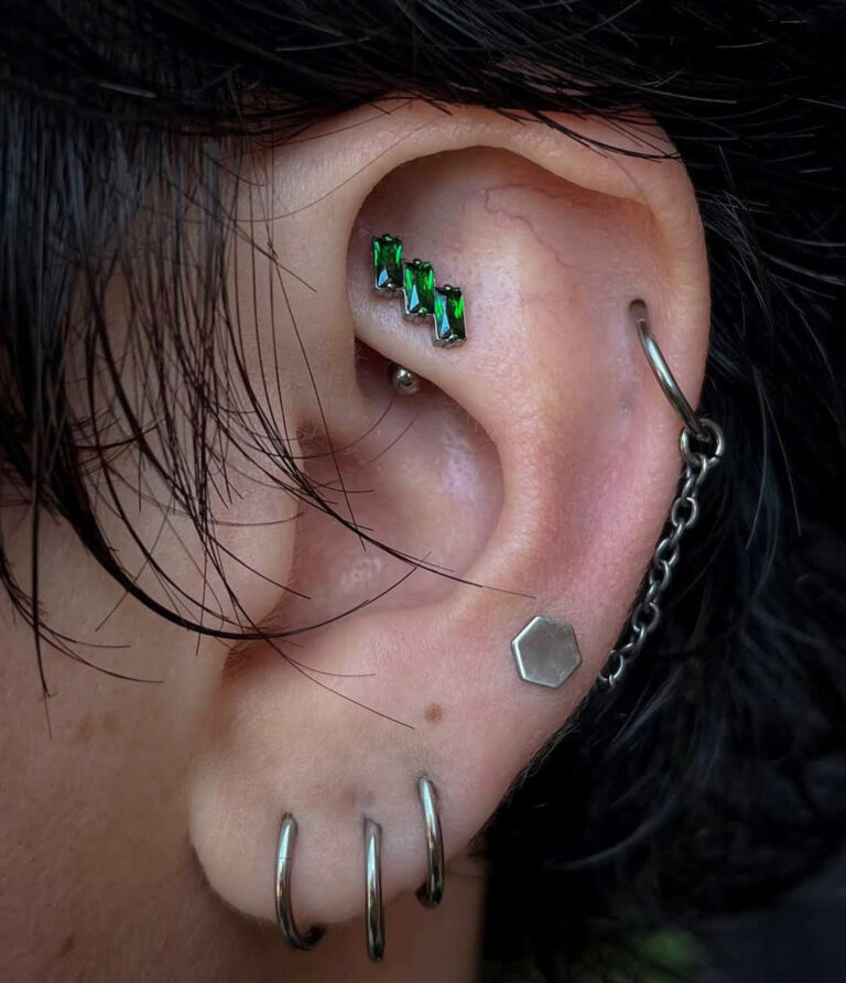 La perforación es solo el comienzo: cómo un piercing puede derivar en años de rehabilitación
