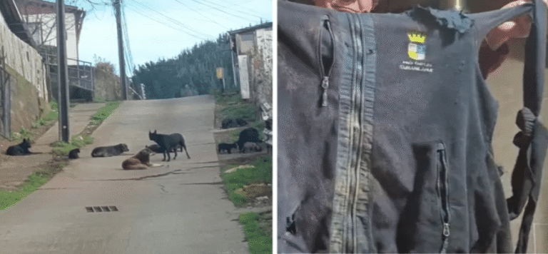 Hombre está hospitalizado tras sufrir brutal ataque de jauría de perros