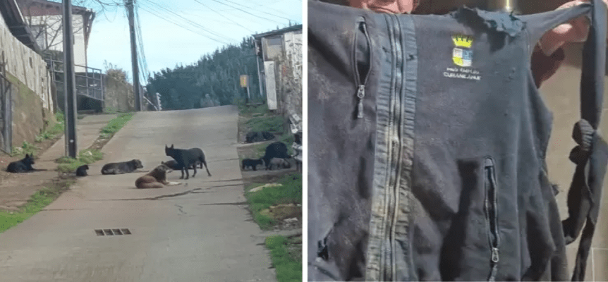 Hombre está hospitalizado tras sufrir brutal ataque de jauría de perros