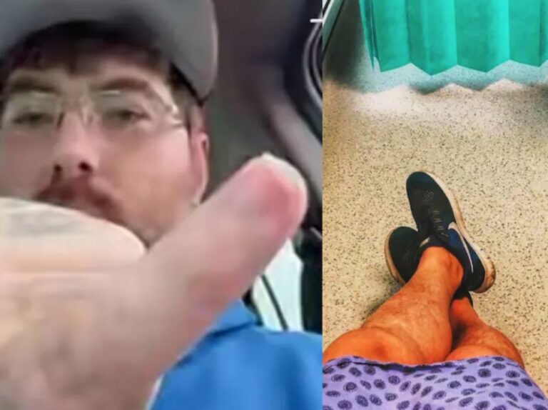 HOMBRE que ASEGURA tener el “PENE MÁS PEQUEÑO DEL MUNDO” se someterá a inédita OPERACIÓN de AUMENTO