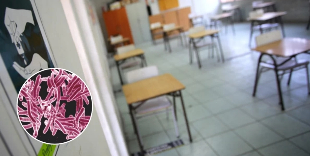 SEREMI de Salud CONFIRMA caso de TUBERCULOSIS en ESTUDIANTE de 14 años de un COLEGIO de Concepción