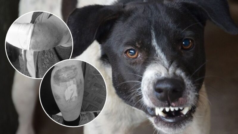 Adulta mayor resulta con graves heridas tras ataque de jauría de perros en San Pedro de la Paz
