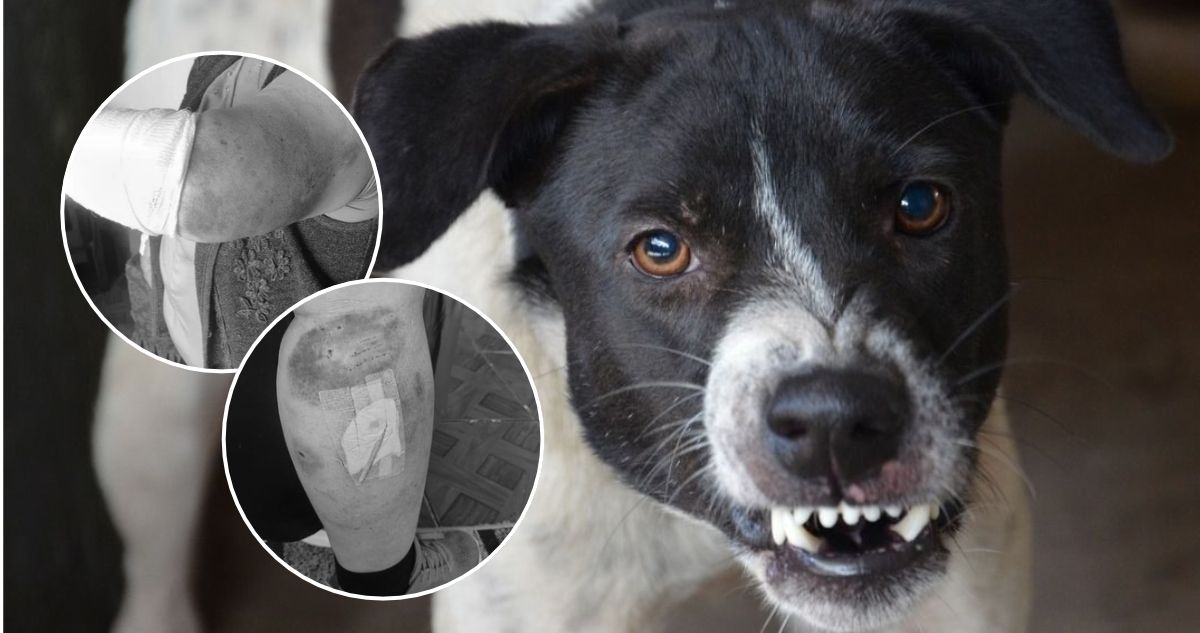 Adulta mayor resulta con graves heridas tras ataque de jauría de perros en San Pedro de la Paz